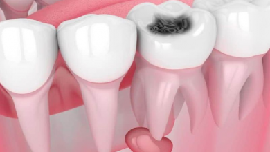 How long until a tooth infection kills you