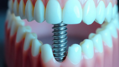 How much does a dental implant cost in nigeria​